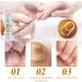 Cuticle Remover Cream Nail Cuticle Remover Gel Cuticle Oil for Nails Cuticle Care Gel Cuticle Remover Liquid Nail Treatments Cuticle Softener and Remover Nail Oil Cuticle Pen Instant Cuticle Remover - Buy Online on GoSupps.com