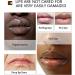 Pink Lip Lightening Treatment Lip Moisturizer Lips Fast Whitening Treatment Dark Lightening Lips Pink Cream Lip Butters Lip Makeup (1pc) - Buy Online on GoSupps.com