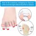 Mcvcoyh Gel Toe Separators Bunion Corrector 8 Pieces Toe Spreaders for Overlapping Hallux Valgus Diabetic Feet for Men and Women 2 Loops Gel Hammer Toe Pads - Buy Online on GoSupps.com