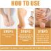 Tongyend Foot Peeling Spray Instant Foot Peeling Spray Foot Callus Removal Spray Moisturizing Hydrating Nourish Peel off Spray Foot Exfoliating Spray Remove Foot Dead Skin-30ML FootCallusRemover - Buy Online on GoSupps.com