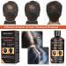 Anti-Hair Loss Shampoo 220mL - Effective Hair Growth Solution for Thinning & Breakage - Stop Hair Loss & Promote Fast Growth - Men & Women Treatment - Buy Online on GoSupps.com