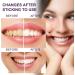Agent de blanchiment des violet Dentifrice Taches de Nettoyage des jaunes Blanchiment Blanchiment la maison Agent de blanchiment des facile des 50 ml Gel Blanchiment Dentaire (A One Size) A 1 unit (Lot de 1) - Buy Online on GoSupps.com