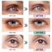 Ruzzut Sakura Essence Under Eye Patches - 30 Pairs for Puffy Eyes & Dark Circles | Anti-Aging & Moisturizing Eye Masks for Face Treatment - Buy Online on GoSupps.com