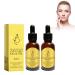 Crsetmyth Frankincense Resin Oil For Face Frankincense Resin Infused Oil Organic Frankincense Oil Frankincense Oil Strengthening antiwrinkle serum castor and jojoba oil for the face moisturizing the