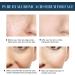 |Most Gifted| Profirm Korean Soluble Protein Thread - Soluble Protein Thread Lifting Instant Face Protein Thread - Absorbable Collagen Thread for Face Lift - Reduce Fine Lines Wrinkle Firming Skin - 60pcs * 1/2/3 (3Box - 180Pcs) - Buy Online on GoSupps.com