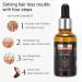 Hair Growth Serum - Prevent Hair Loss & Thinning Deep Nourishing Formula for Follicle Repair 30ml | Buy Online Worldwide - Buy Online on GoSupps.com