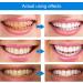 Buy 2-Piece Gum Therapy Gel for Effective Periodontal Treatment | Brightening Tooth Health Gel - Buy Online on GoSupps.com