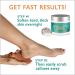 Callus Remover Gel & Foot Scrubber Kit â€“ Ultimate Pedicure Tools for Dry Cracked Heels - Buy Online on GoSupps.com