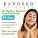 Exposed Skin Care Moisture Complex - Hydrating Vitamin E and Green Tea Extract - 1.7 fl oz - Buy Online on GoSupps.com