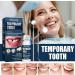Temporary Tooth Repair Kit with Dental Mirror Tools - Replacement Beads for Missing & Broken Teeth - Buy Online on GoSupps.com
