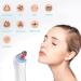 2023 Newest GERY Blackhead Remover Pore Vacuum Extractor Kit | Facial & Nose Peel Tool with Red&Blue Light | Electric Comedone Acne Extractor | 4 Probe Set - Buy Online on GoSupps.com