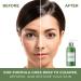 Teami Facial Cleanser with Salicylic Acid, Aloe, Matcha & Sea Kelp - Organic Acne Face Wash - Best Hydrating Skin Care for Women - Buy Online on GoSupps.com