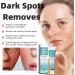 Fade Stain Beauty Cream Freckle Remover Cream Dark Spot Remover for Face Dark Spot Correcting Glow Serum Dark Spots Remover Dark Spot Corrector Cream Age Spot Remover Dark Spot Cream Spot Remover - Buy Online on GoSupps.com