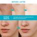 Healpool Rapid Dark Spot Remover for Face and Body - Dark Spot Corrector Serum - 1.7oz - Buy Online on GoSupps.com