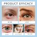 Stye Eye Treatment & Chalazion Remover | Eye Relief Serum & Gentle Lash Cleanser - Fast International Shipping - Buy Online on GoSupps.com