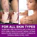 Silicone Scar Sheets - Clear Invisible Tape for Surgical C-Section Keloid Burn & Acne Scars - 1.6 x 60 Effective Scar Treatment - Buy Online on GoSupps.com