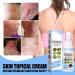 DUBUSH Psoriasis & Eczema Soothing Mist Set - Herbal Treatment for Skin Rejuvenation | All Skin Types - 3pcs - Buy Online on GoSupps.com