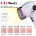 IMENE IPL Permanent Hair Removal for Women & Men - 500,000 Flashes, Ice Compress, Home Use - Buy Online on GoSupps.com