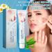Acne Repair Face Cream - Moisturiser Face Women - Face Moisturizer for Women - Deeply Nourishes Skin - Skin Lightening Cream - Light Texture and Easy Absorption - Buy Online on GoSupps.com