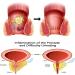 AILLAUS Heca Herbal Hemorrhoid Capsules - Fast Relief from Burning & Discomfort (8pc) - Buy Online on GoSupps.com