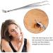 EasyULT Tick Remover Sided Stainless Steel Tick Remover with Storage Iron Box Easy Remove Ticks Tick Remover Tool for Humans Dogs Cats - Buy Online on GoSupps.com