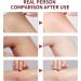 Peach Exfoliator Face Scrub Pore Face Scrub Nourishing Exfoliating Cream Shrink Pores & Improve Rough Skin Arm & Back & Leg Anti Acne Scrub for Face Hand Scrub Exfoliator-Dark Spot Cleanser-All Skin - Buy Online on GoSupps.com