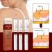 Anti Wart - Anti Wart Pen - Pen To Remove Mole - Anti Skin Tag Pen - Pen To Remove Skin Tags Remove Skin Tags - Buy Online on GoSupps.com