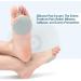 Metatarsal Pads Forefoot Sleeve with Soft Gel | Women Men | Metatarsalgia, Neuroma, Calluses Relief | L(W 8-10 M 9-11) - Buy Online on GoSupps.com