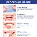 28 Tooth Whitening Strips - Effective Stain Removal & Enamel Safe Mint Taste | Fast Teeth Bleaching for a Bright Smile - Buy Online on GoSupps.com