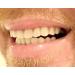 Instant Smile Comfort Fit Flex Teeth - Natural Shade Upper and Lower Kit with Vented Cleaning Case | Shop Now - Buy Online on GoSupps.com