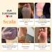 Scala Foot Peel Mask Treatment - 2 Pack Dead Skin Remover & Exfoliator Gel for Soft, Smooth Feet - Buy Online on GoSupps.com