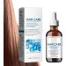 Scalp and Hair Strengthening Oil | Oil for Hair Growth & Healthy Scalp | Hair Growth Oil | Hair Premium Hair Growth and Scalp Oil for Strong and Healthy Hair for Healthy and Shinier Hair - Buy Online on GoSupps.com