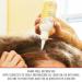 First Aid Beauty Anti-Dandruff Scalp Serum - Fights Dandruff & Soothes Dry Scalp - 3 oz - Buy Online on GoSupps.com