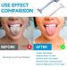 RorincoGi Tongue Scraper 2 Pack - Soft Tongue Cleaner for Fresh Breath - Oral Care Tools for Adults & Kids - White & Blue - Buy Online on GoSupps.com