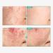Dexpanthenol Cream 170 000ppm B5 - Ultimate Skin Barrier Repair & Hydration | Korean Skincare 60ml - Buy Online on GoSupps.com