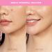 FOREO ESPADA LED Acne Treatment Device - Pink | Effective Spot Treatment - Buy Online on GoSupps.com