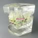 Shop Dental Malocclusion Orthodontic Treatment Model - Metal Brackets & Colorful Ties | M3005 - International Shipping Available - Buy Online on GoSupps.com