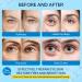 LANBENA Hyaluronic Acid Eye Mask - Collagen Patches for Dark Circles & Eye Bags (30 Pairs) - Hydrating Skin Care - Buy Online on GoSupps.com