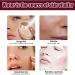 AHA 30% + BHA 2% Face Serum for Hydrated Dark Spot Remover for Face Facial Serum for Anti Wrinkle and Smooth Skin Moisturiser Face Anti Aging Serum for Face Brightening Serum for Women - Buy Online on GoSupps.com