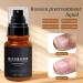 Nail Care Spray Quickly Softened Dead Skin Nutrition Fluid Cuticle Remover Revitalizers Feet Repair Products Convenient Spray Cover - Buy Online on GoSupps.com