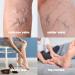 HillVital Varicose Veins Treatment Cream - Natural Horse Chestnut & 14 Herbs for Spider Veins & Leg Relief - Buy Online on GoSupps.com