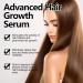 Hair Growth Serum Organic Castor Oil Anti Hair Loss Hair Serum for Thinning Balding Thin Hair Fast Growth Strengthen Hair Roots for Men & Women Damaged Hair Repair - Buy Online on GoSupps.com