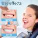 Provisional Dentures - 2 Pairs of Cosmetic Veneers & Fake Braces for Men & Women | International Shipping Available - Buy Online on GoSupps.com