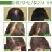 Shelure Hair Growth Oil Shelure Hair Regrowth Oil Shelure Hair Regrowth Treatment Oil Natural Hair Growth Oil Hair Regrowth Extract Oil Hair Growth Oil for Women (1) - Buy Online on GoSupps.com