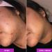 Good Molecules Discoloration Correcting Serum 75ML - Buy Online on GoSupps.com