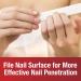 Kerasal Nail Renewal and File Combo Pack - 5 Heavy Duty Nail Files, 0.33 fl oz - Restores Discolored/Damaged Nails - Buy Online on GoSupps.com