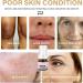 Aobenz Serum Aobenz Whitening and Freckle Removing Essence Aobenz Anti-Spot Serum Aobenz Spot Remover Serum Aobenz Dark Spot Correcting Serum Aobenz Spot Remover for Face Wrinkle Power (2pc) - Buy Online on GoSupps.com