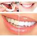 Giural 2 PCs Temporary Teeth - Cling to a Perfect Smile for Men & Women | Fix Broken & Missing Teeth - Buy Online on GoSupps.com