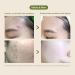 Blith Defined Spray Mask - Soothing Green Tea & Lactic Acid Face Peeling for Acne-Prone Skin (150ml) - Gentle Exfoliation & Healing - Buy Online on GoSupps.com