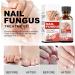 Tlopa Nail Growth And Strengthening Serum Nail Growth and Strength Serum Toenail Growth Treatment for Damaged Nail Stronger Nails in 1 Week Nail Strengthening Treatment (3PC) - Buy Online on GoSupps.com